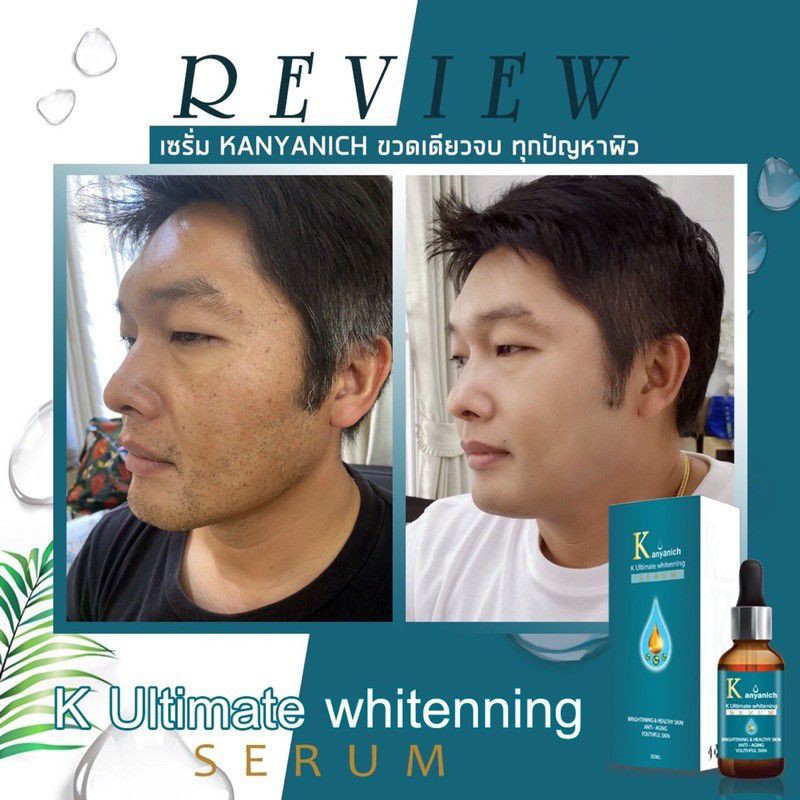 kanyanich-k-ultimate-whitening-serum-เซรั่มหน้าเด็ก-สุดยอดนวัตกรรมใหม่จากญี่ปุ่น-แก้ปัญหาตรงจุดที่สุด