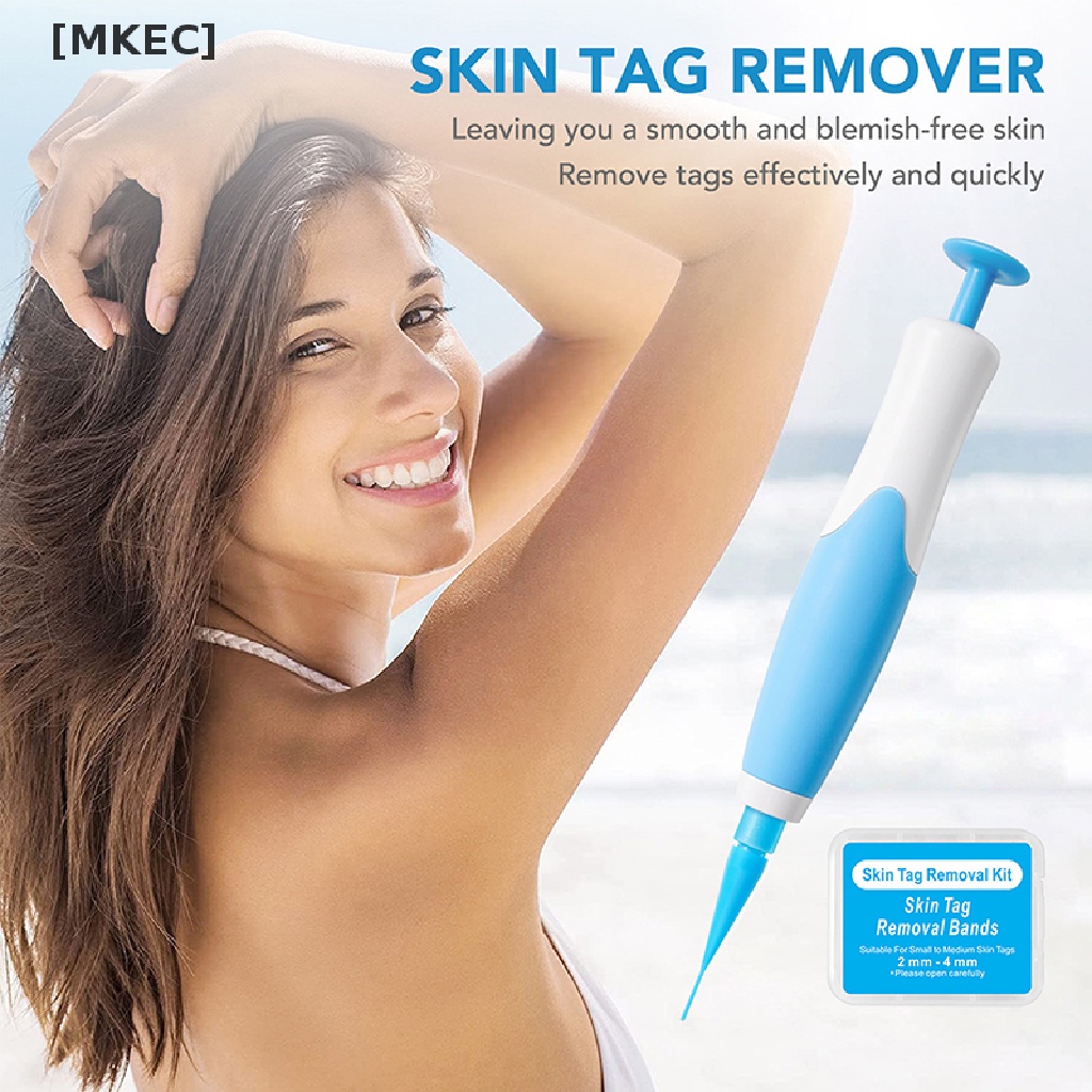 mkec-painless-auto-skin-tag-removal-kit-skin-tag-bands-remover-device-new-hot-sell