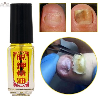 【DREAMER】New 3 Days Effect Treatment Removal of onychomycosis Paronychia Anti oil Fungal Nail Fungus oil Care