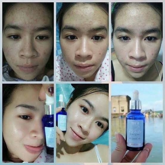 พร้อมส่ง-เซรั่มณัชชา-natcha-serum-ปริมาณ-30-มล