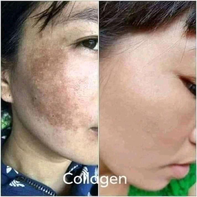 ครีมคอลลาเจน-มาเลเซีย-collagen-plus-vit-e-หน้าใส