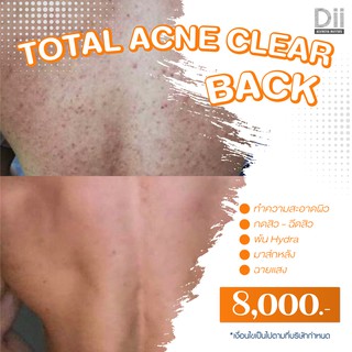 Dii Aesthetic : Total Acne Clear Back 1 Time