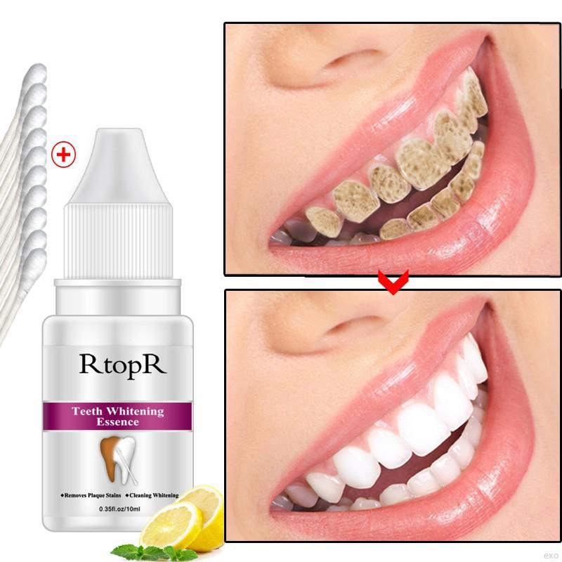 New ♕ exo ღ RtopR Teeth Whitening Serum Gel Tooth Hygiene Effectively ...
