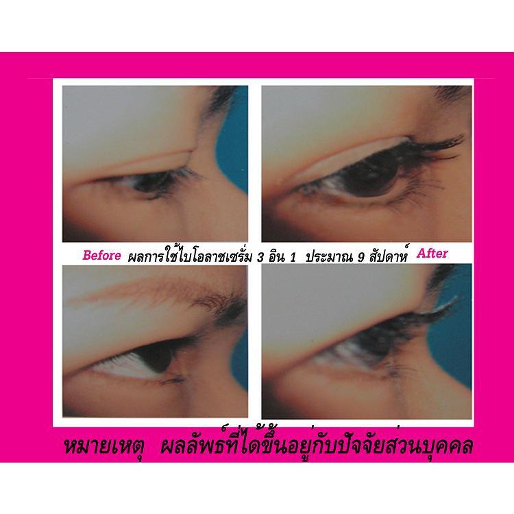 แพคคู่-bio-lashes-เซรั่มสมุนไพรเร่งขนตายาวและหนาขึ้น