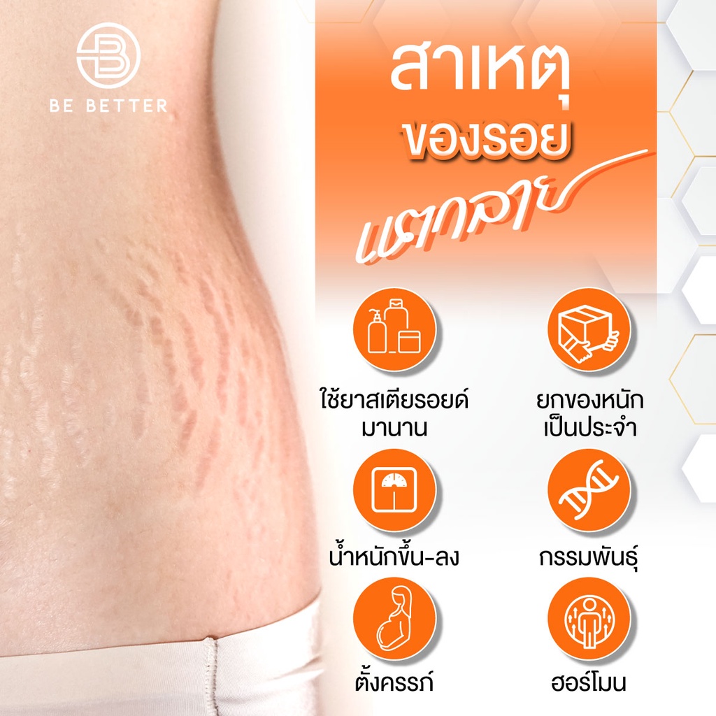 6ขวด-ครีมลดรอยแตกลาย-be-better-6ขวด-น้ำตบสยบรอยแตก-ครีมขาลาย-ก้นลาย-ครีมแก้ท้องลาย