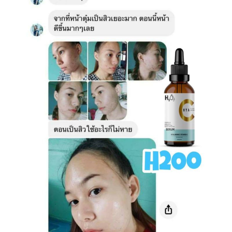 ของแท้-มีของแถม-เซรั่มไฮยา-h2oo-vitamin-c-เซรั่มไฮยารูรอนเข้มข้น-บูทผิว-ลดริ้วรอย-หย่อนยาน-โทรมหมองคล้ำหน้าเด็กอีกครั้ง