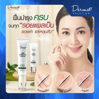 Skin Repairing Spot Corrector (15 g) หลุมสิว รอยแผลเป็น แก้หลุมสิว รอยแผลเป็นจากสิว รักษาหลุมสิว ยาลดรอยแผลเป็นจากสิว