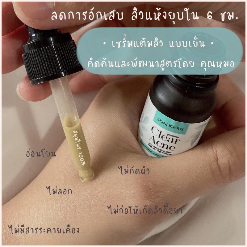 ที่แต้มสิว-skinlicious-หัวสิวแห้งไว-ลดการอักเสบ-ป้องกันการเกิดสิว