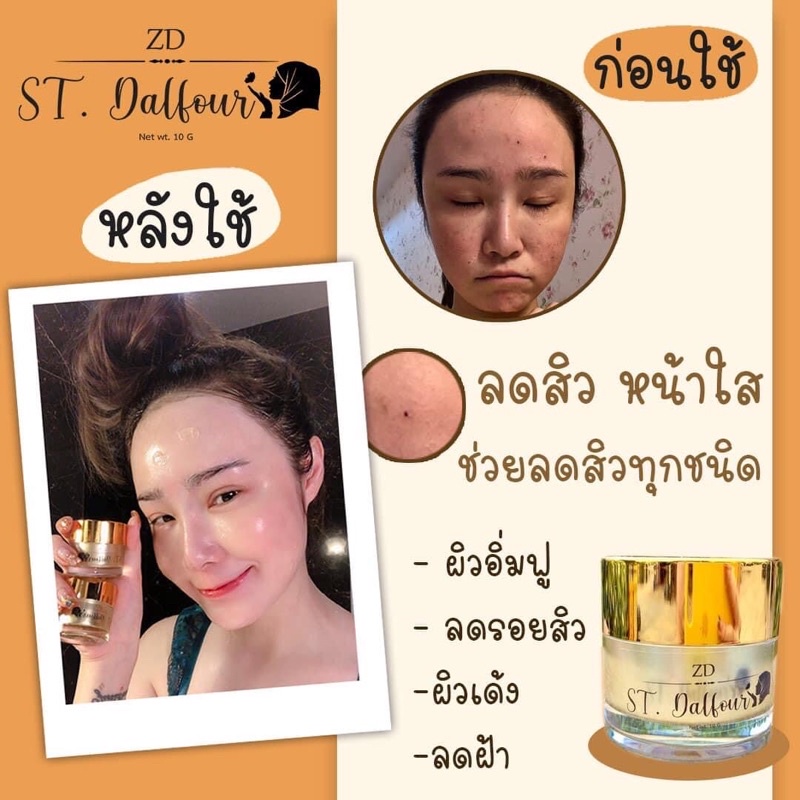 ครีมคูเวต-นำเข้าของแท้ล้าน-สูตรที่ดีที่สุด-หน้านุ่มฉ่ำ-ลดสิวฝ้าหน้าใสกิ๊ก