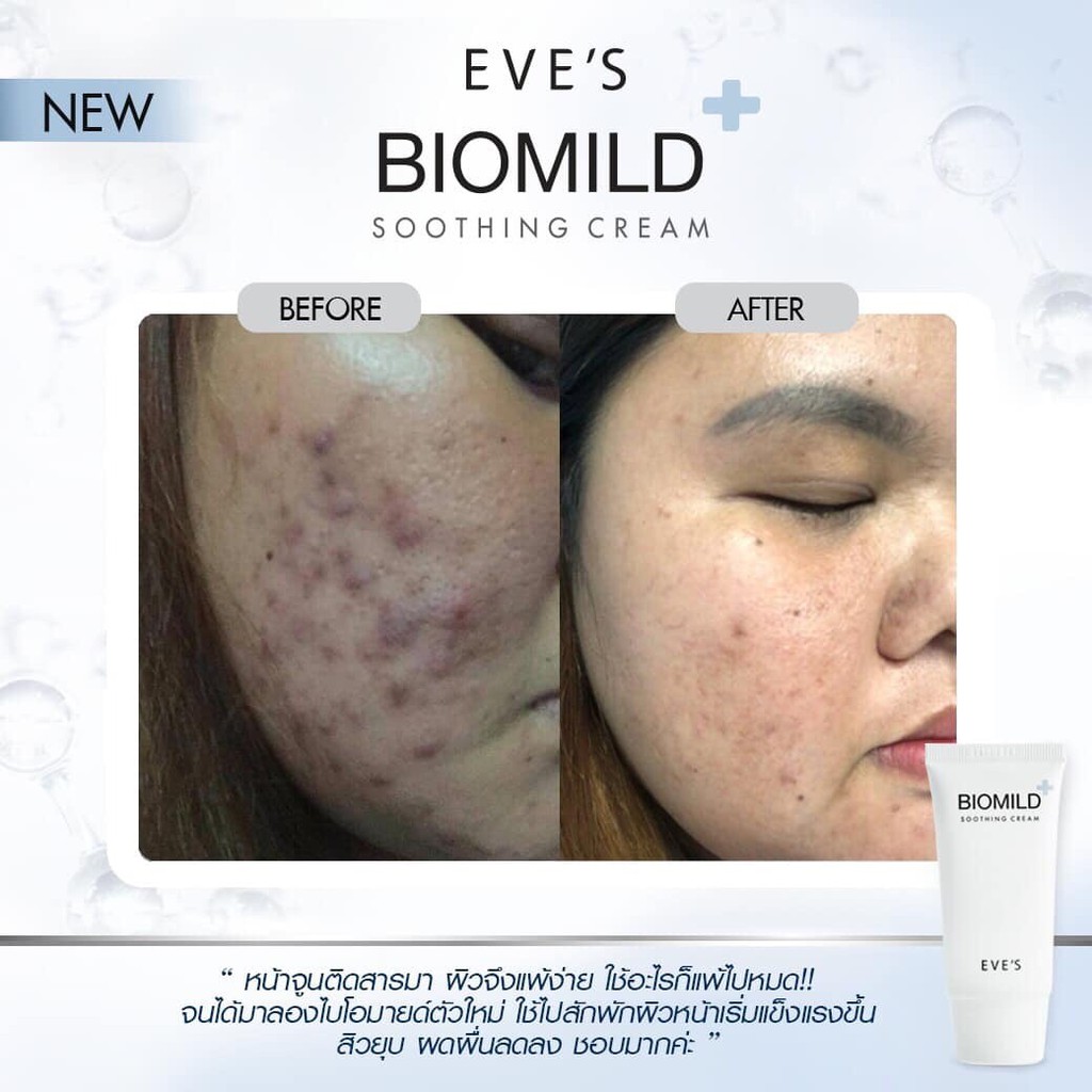 ไบโอมายด์-แท้-eves-l-บำรุงผิวหน้าลดอาการแพ้-ระคายเคือง-biomild-soothing-cream