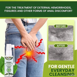 Natural Herbal Hemorrhoids Spray 30ml Pain Relief No Stimulation Hemorrhoid Treatment Hemorrhoids Spray Hemorrhoids Oint