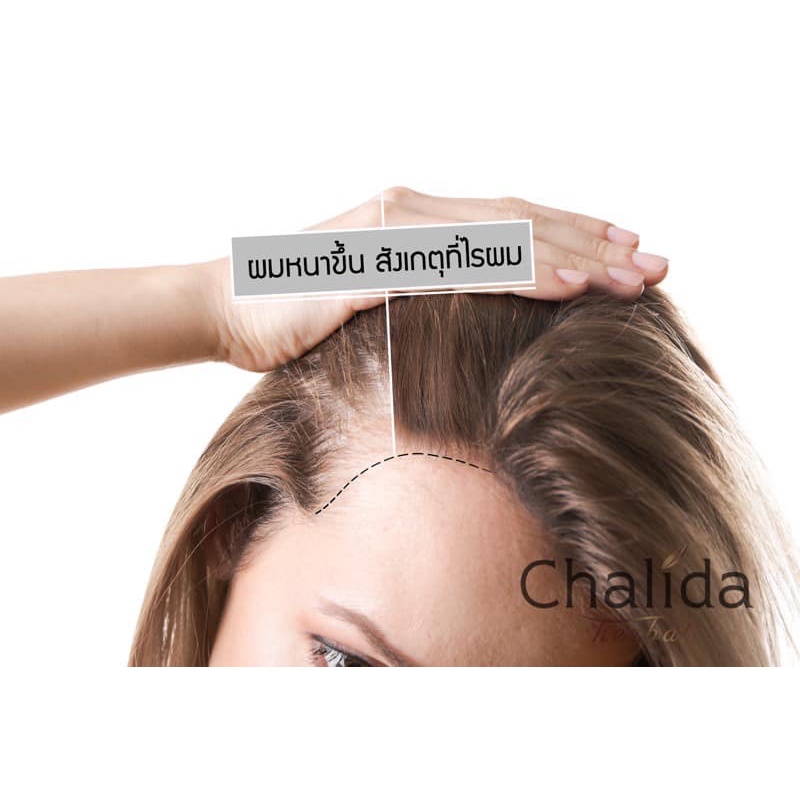 chalida-herbal-แชมพูและครีมนวดผม-สูตรรวงข้าว-อ่อนโยน-สำหรับผู้ที่แพ้ง่าย