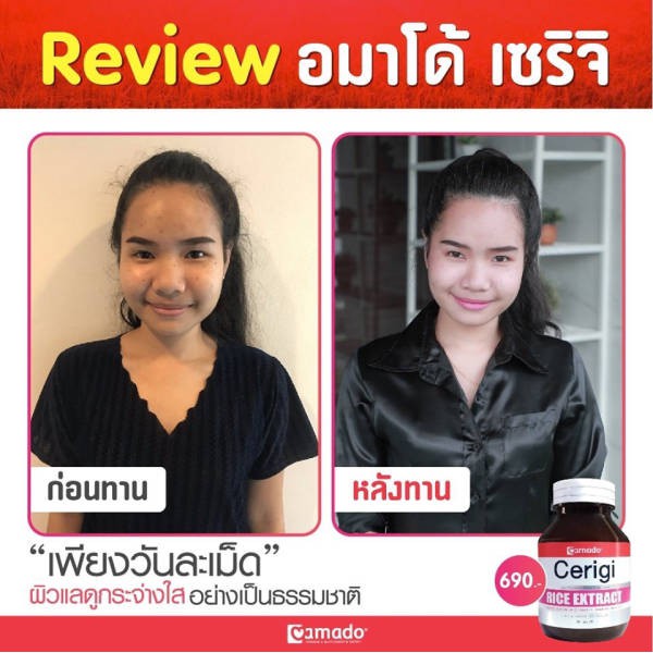 ภาพสินค้า(ของแท้) อมาโด้ เซริจิ Amado Cerigi Rice Extract รำข้าวอมาโด้ จากร้าน honeylimeshop บน Shopee ภาพที่ 5