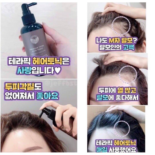 มาใหม่-ของเเท้-100-สเปรย์ตัวฮิตของเกาหลี-terapic-premium-total-hair-tonic-150ml-ลดการขาดหลุดร่วงของเส้นผมพร้อมบำรุง