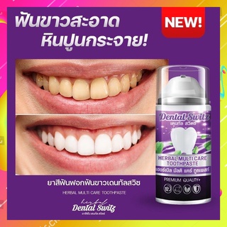 ยาสีฟัน Dental switz [1 แถม 1 ส่งฟรี]เจลฟอกฟันขาว ยาสีฟันฟอกฟันขาว กลิ่นปาก หินปูน ฟอกฟันเองที่บ้าน แบบมีราง