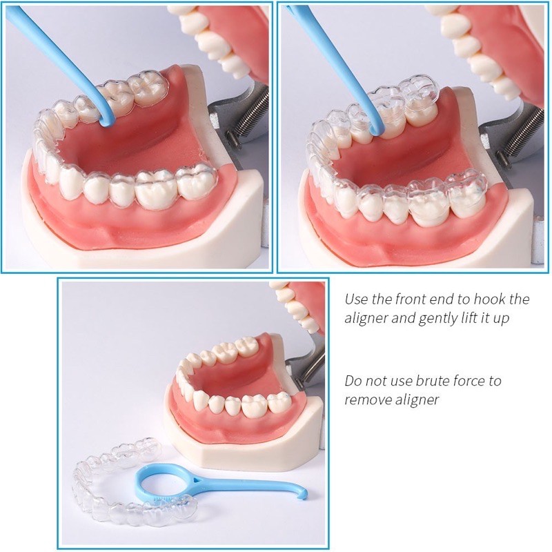 aligner-remover-ที่ถอด-aligner-invisalign-รีเทนเนอร์ใส