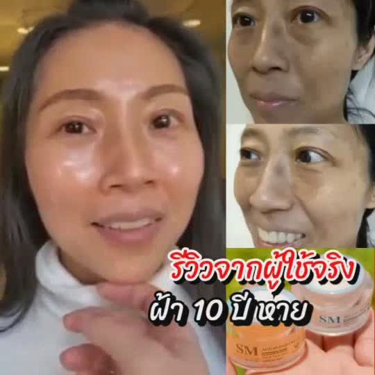 ของแท้-ขายแยกชิ้น-ชุด10กรัม-ชุด15กรัม-ครีมsm-ครีมรักษาฝ้า-ครีมทาฝ้า-ครีมหน้าขาว-ครีมรักษาสิว