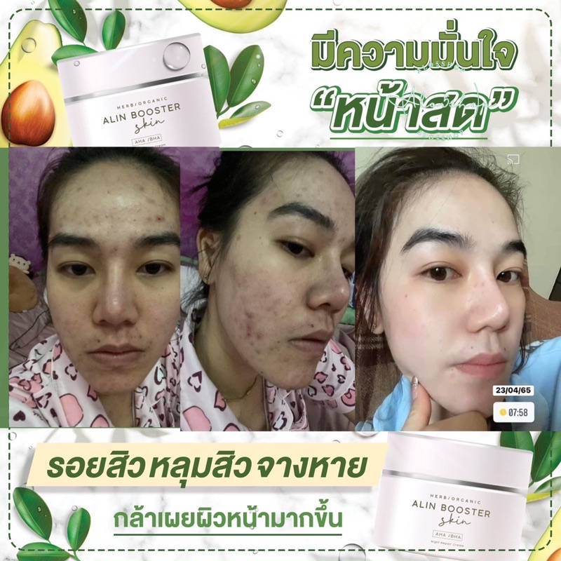 alin-booster-ครีมรักษาสิว-ครีมหน้าขาว-อลินบูสเตอร์-ส่งไว-ครีมหน้าใส-ลดจุดด่างดำ-ฝ้ากระ