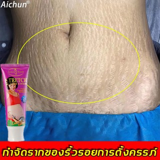 Aichun ครีมลดรอยแตกลาย 120g ครีมทาท้องลาย ครีมทาท้อง ครีมท้องลาย ครีมลดรอยแตก ครีมแก้ท้องลาย ครีมท้องแตกลาย ลดรอยแตกลาย