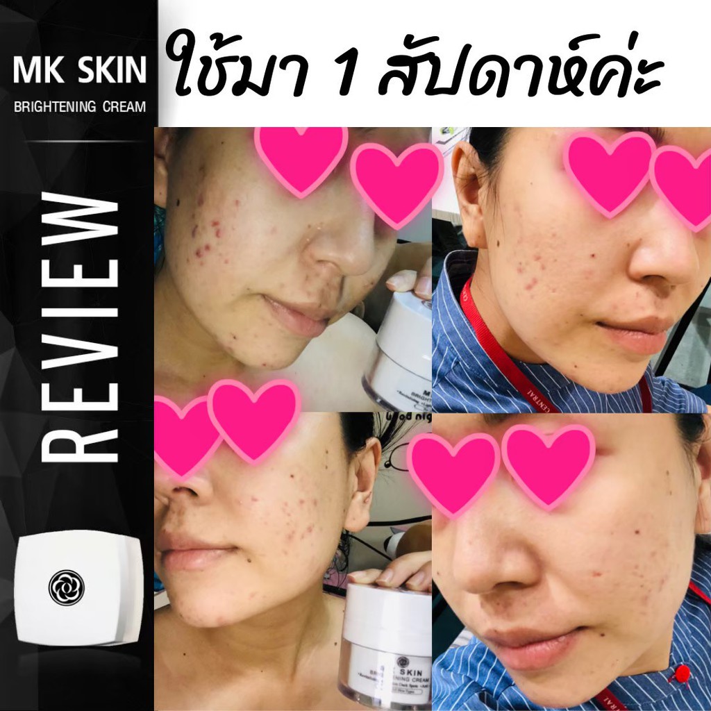 ส่งฟรี-mkb-เวชสำอาง-สำหรับผิวแพ้ง่าย-ช่วยลดผดผื่น-แก้แพ้-ทาได้ทุกสภาพผิว-แม่ท้อง-ให้นม-แนะนำให้ใช้ค่ะ