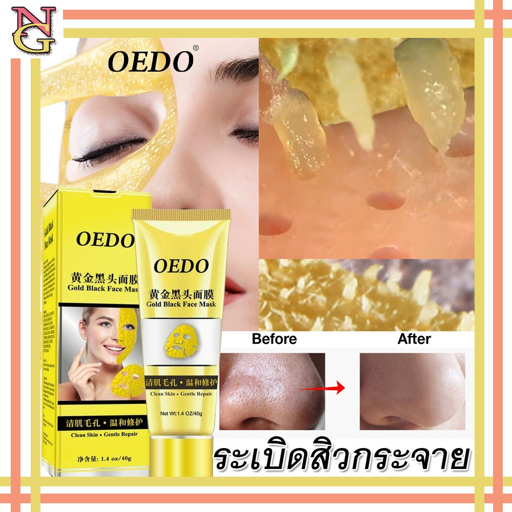 ส่งจากไทย-oedo-มาร์คหน้ารักษาสิว-มมาร์คหน้ารักษาสิว-มาร์ครักษาสิวหัวดำลอกสิวเสี้ยน