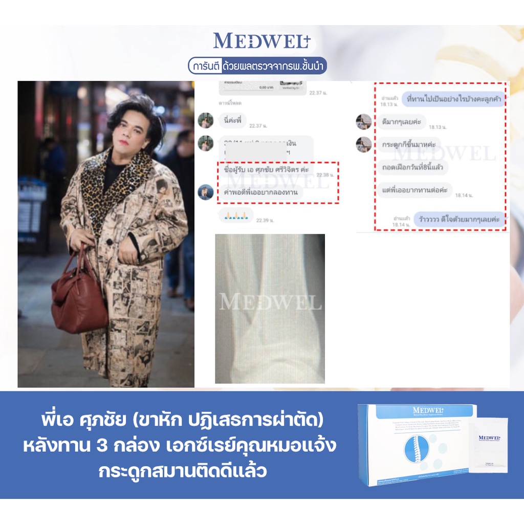 ภาพสินค้าฟื้นฟูกระดูกและข้อเข่า MEDWEL(เมดเวล) ฟื้นฟูกระดูกเสื่อม เข่าเสื่อม แคลเซียมบำรุงกระดูก คอลลาเจนบำรุงกระดูก จากร้าน medwel บน Shopee ภาพที่ 6