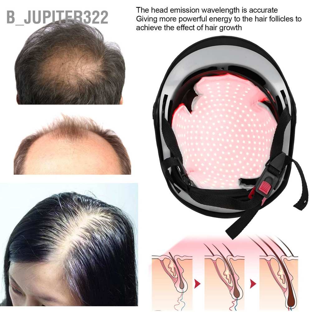 b-jupiter322-280pcs-lamp-beads-hair-loss-treatment-device-red-light-therapy-growth-helmet-black