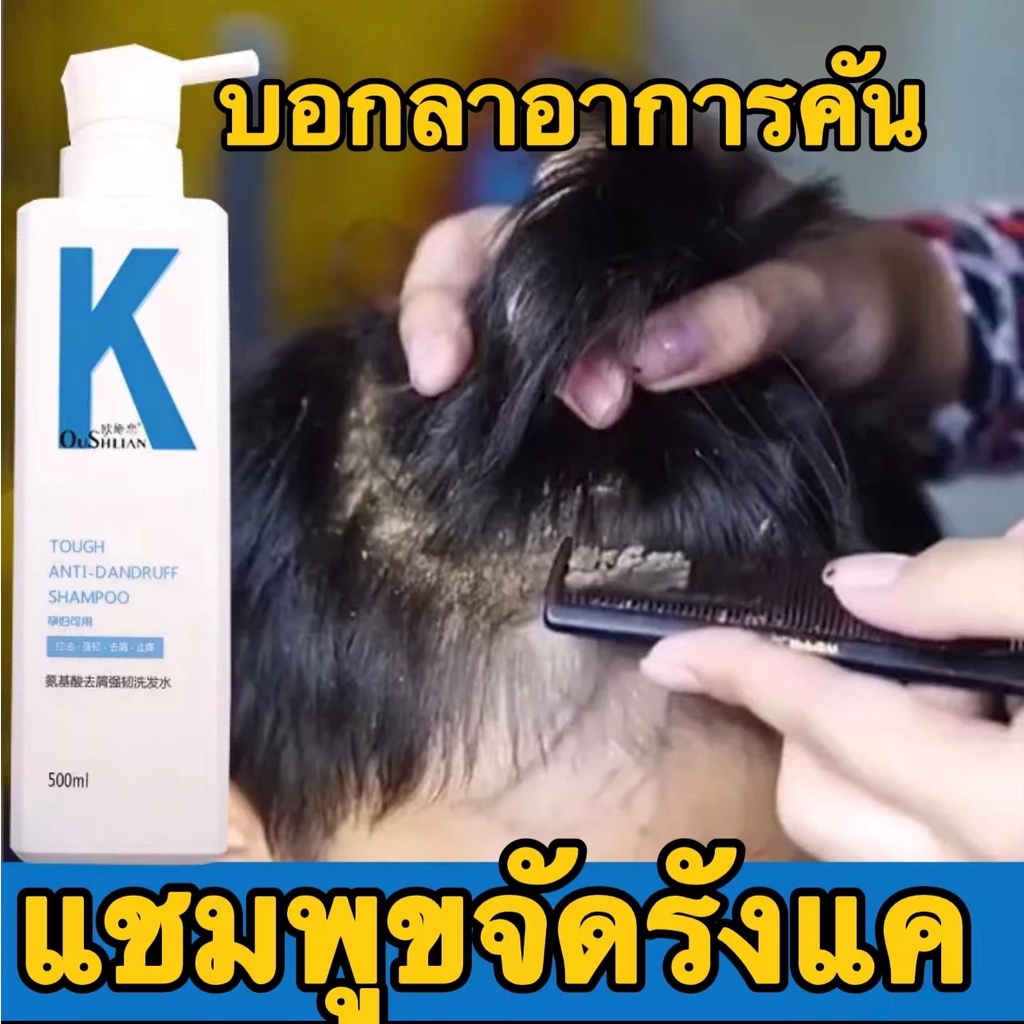 แก้อาการคันหนังศรีษะ-1-ขวด-oushlian-แชมพูขจัดรังแค-สำหรับคันหนังศีรษะ-แชมพูกําจัดรังแค-ยาสระผมขจัดรังแค-ยาสระผมรังแค