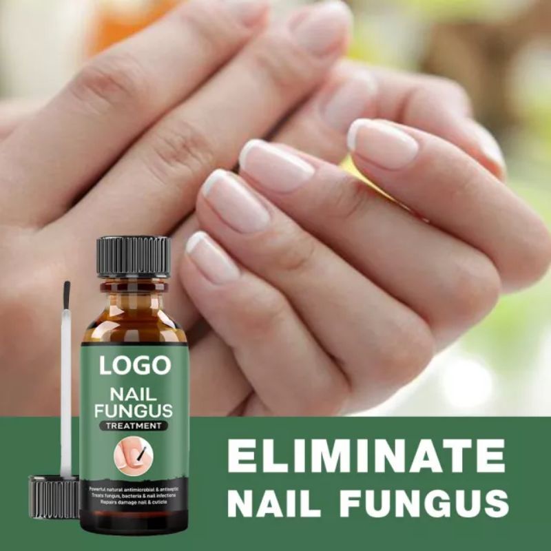 nail-fungus-วิธีแก้ปัญหาการรักษาเชื้อราเล็บ-มือและเล็บเท้าที่แข็งแรงติดเชื้อรา10ml