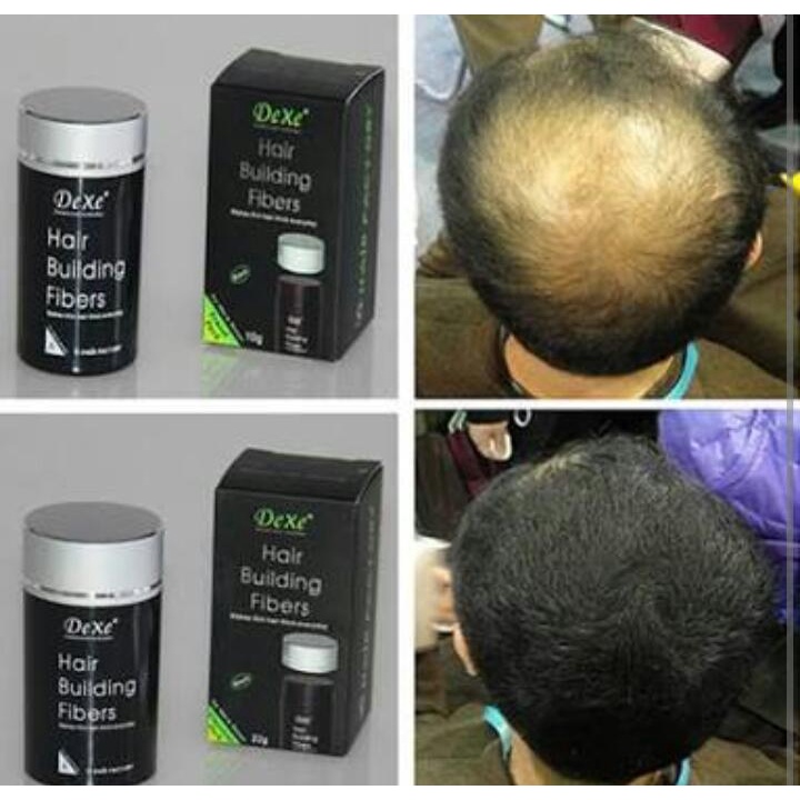 dexe-hair-building-fiber-ไฟเบอร์เพิ่มผมหนา-ปิดผมบาง-หรือรอยแสกกว้าง-dexe-hair-bui