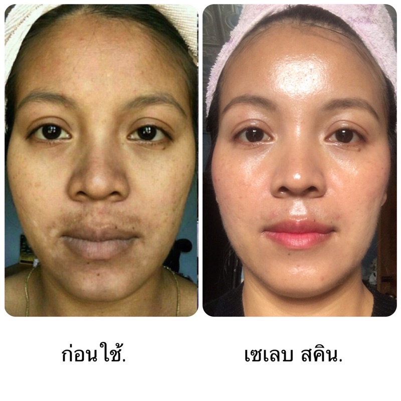 celeb-skin-happiness-akira-pore-tightening-emulsion-6g-ราคา-1-355-baht