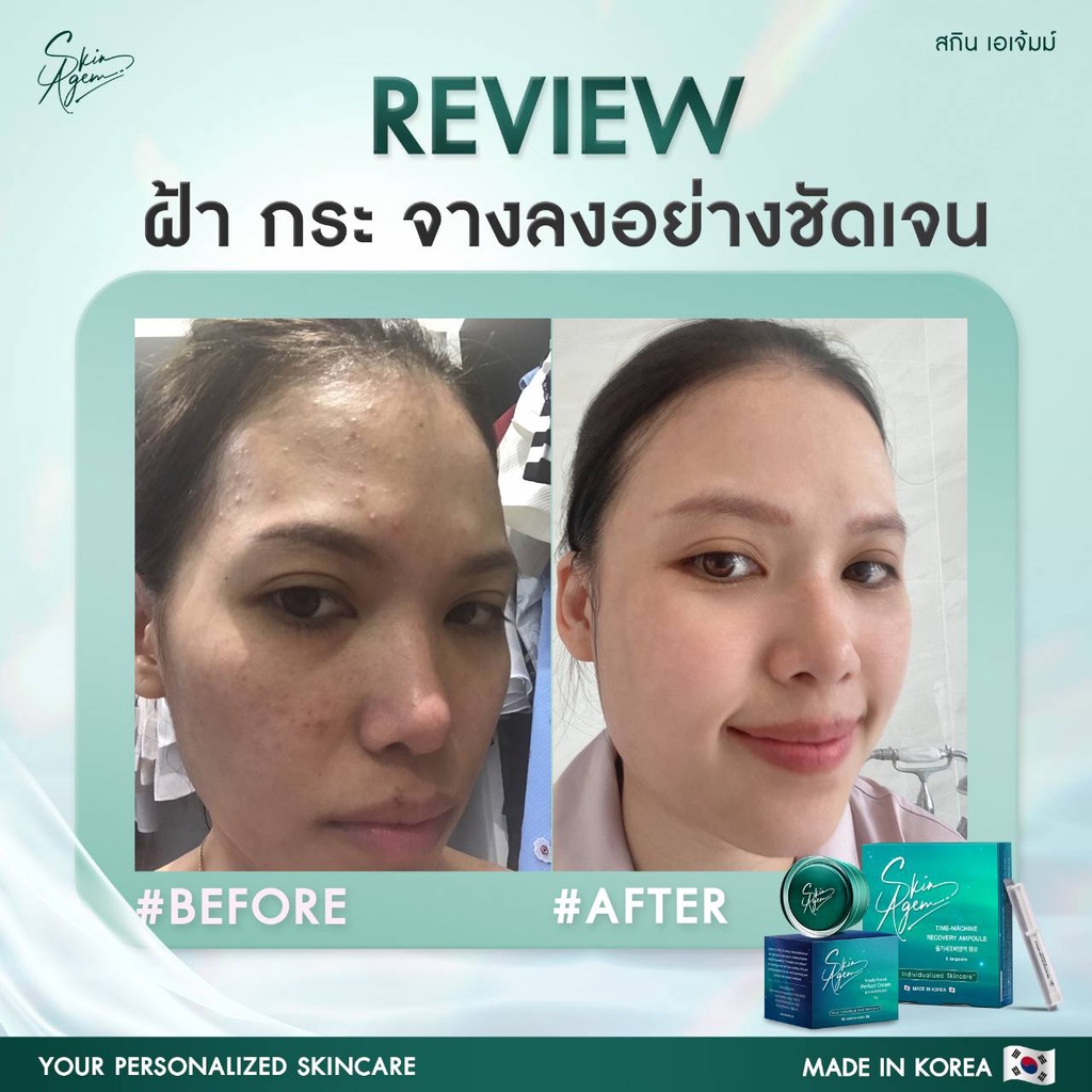 ส่งฟรี-skin-agem-ampoule-perfect-cream-บำรุงลึกถึงระดับเซลล์ต้นกำเนิด-ผิวกระจ่างใส-ลดฝ้า-ครีมหน้าเรียว-แอมพูลกู้หน้า