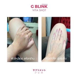 ภาพขนาดย่อของภาพหน้าปกสินค้าG BLINK Vita Shot จีบลิ้ง กลูต้านำเข้า จากญี่ปุ่น จากร้าน skinbeauty1 บน Shopee ภาพที่ 4