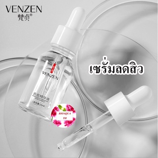 เซรั่มบำรุงผิวหน้าสูตรช่วยลดสิว ช่วยลดการอักเสบของสิว Images Anti Acne Essence 15 Ml.