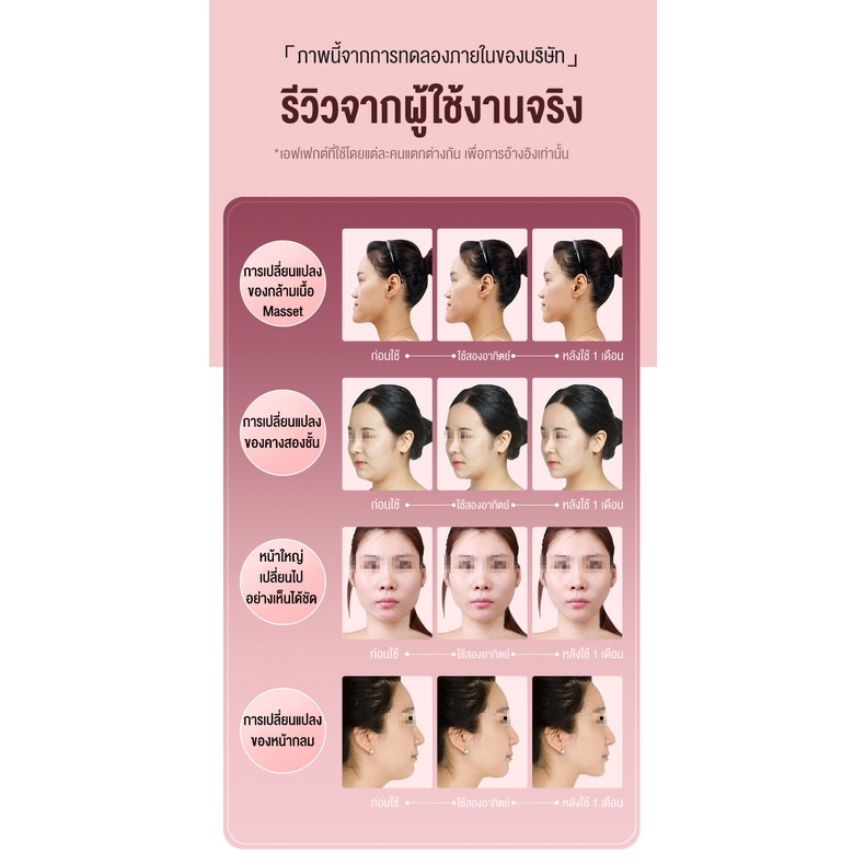 หน้าเรียว-12ระดับ-เครื่องนวดหน้า-ที่นวดหน้า-กระชับผิวให้เต่งตึง-ลดริ้วรอย-การสั่นสะเทือนที่ปรับได้