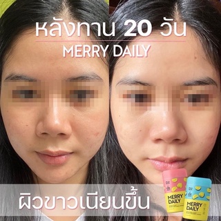 ภาพขนาดย่อของภาพหน้าปกสินค้าMerry Daily วิตามินผิวขาว 2แถม1  บำรุงผิว กระจ่างใส เมอร์รี่ เดย์ลี่ pichlook อาหารเสริม คอลลาเจน จากร้าน teenoi.skin บน Shopee ภาพที่ 8