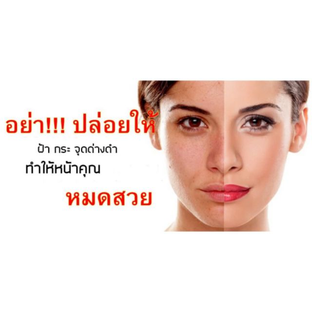 ส่งฟรีทันที-ครีมทาฝ้า-กระ-จุดด่างดำ-เห็นผลมากที่สุด-220