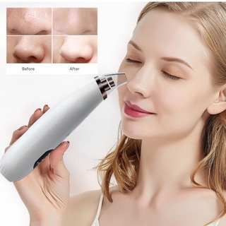 สินค้า Enchen EB-1001 Blackhead Remover เครื่องดูดสิวเสี้ยน  ที่ดูดสิวเสี้ยน สิวข้างจมูก ไม่เจ็บไม่ทำร้ายผิวหนัง (245458)