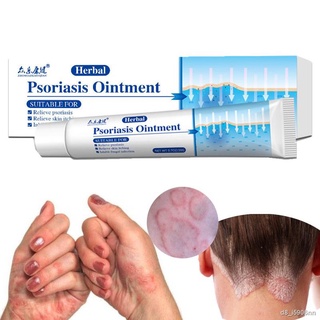 Herbal Psoriasis Cream Treatment Eczema Dermatitis Remove Foot Psoriasis Antipruritic Antibacterial Herbal Ointment Skin