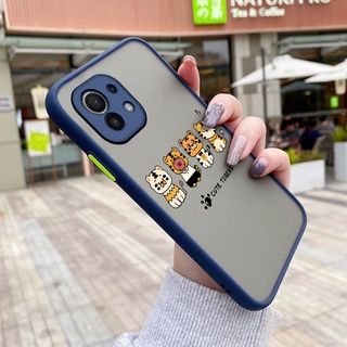 เคสโทรศัพท์มือถือแบบแข็ง ใส กันรอยเลนส์กล้อง ลายเสือน้อย สําหรับ Xiaomi 11 Lite 4G 11 Lite 5G Ne 11 Pro 11 Ultra