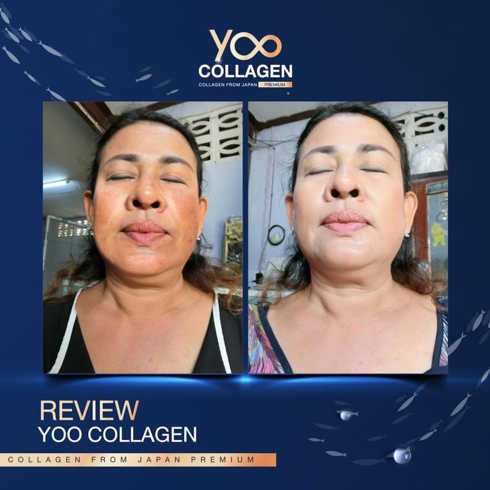 yoo-collagen-ยูคอลลาเจน-คอลลาเจนบริสุทธิ-จากประเทศญี่ปุ่น-กินดีมาก-มีรีวิว-ส่งฟรี-มีสินค้าพร้อมส่งทันที