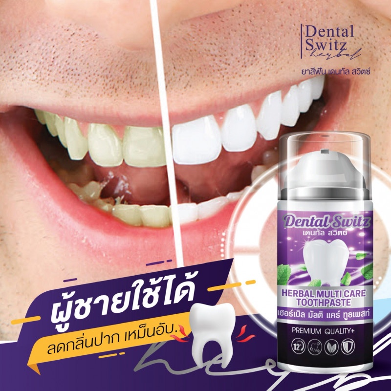 ยาสีฟัน-dental-switz-เดนทัลสวิตซ์-เจลฟอกฟันขาว-ขายแยกชิ้น