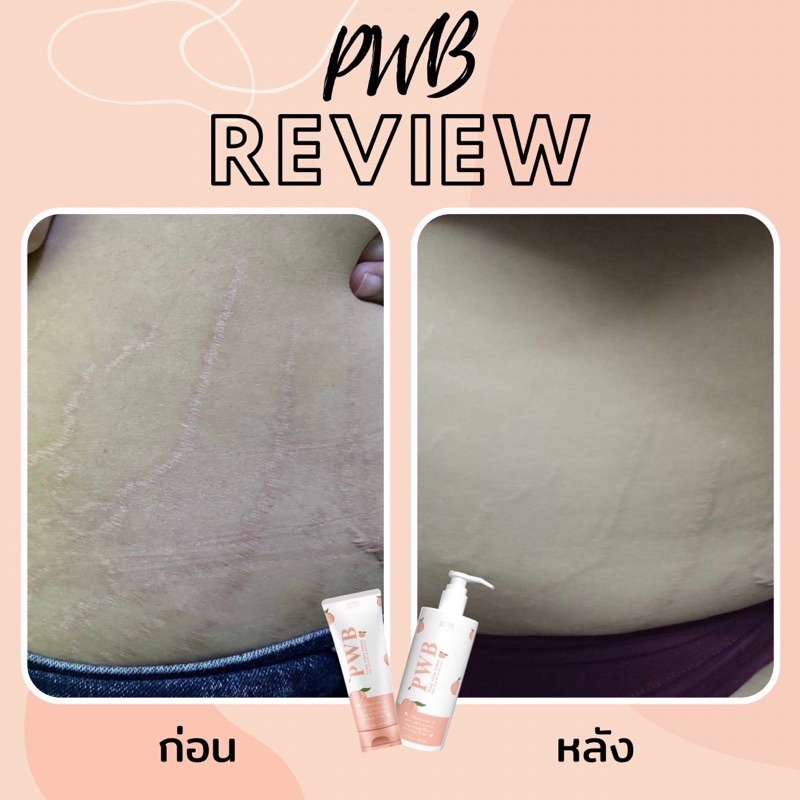 pwb-ครีมลดรอยแตก-มีปลายทาง-amp-ของแถม-ครีมทาก้น-ลดขาลาย-120-g