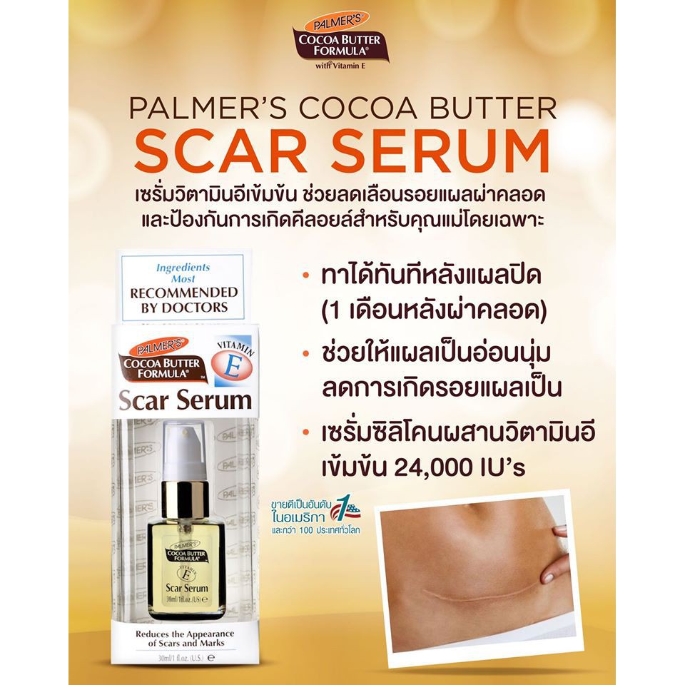 หมดอายุปี2027-ทาแผลผ่าคลอด-ผ่าตัด-palmers-scar-serum-30-ml-ปาล์มเมอร์-สการ์-เซรั่ม