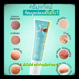 Defenza cream ครีมแก้แพ้ ไม่มีสเตอร์รอย