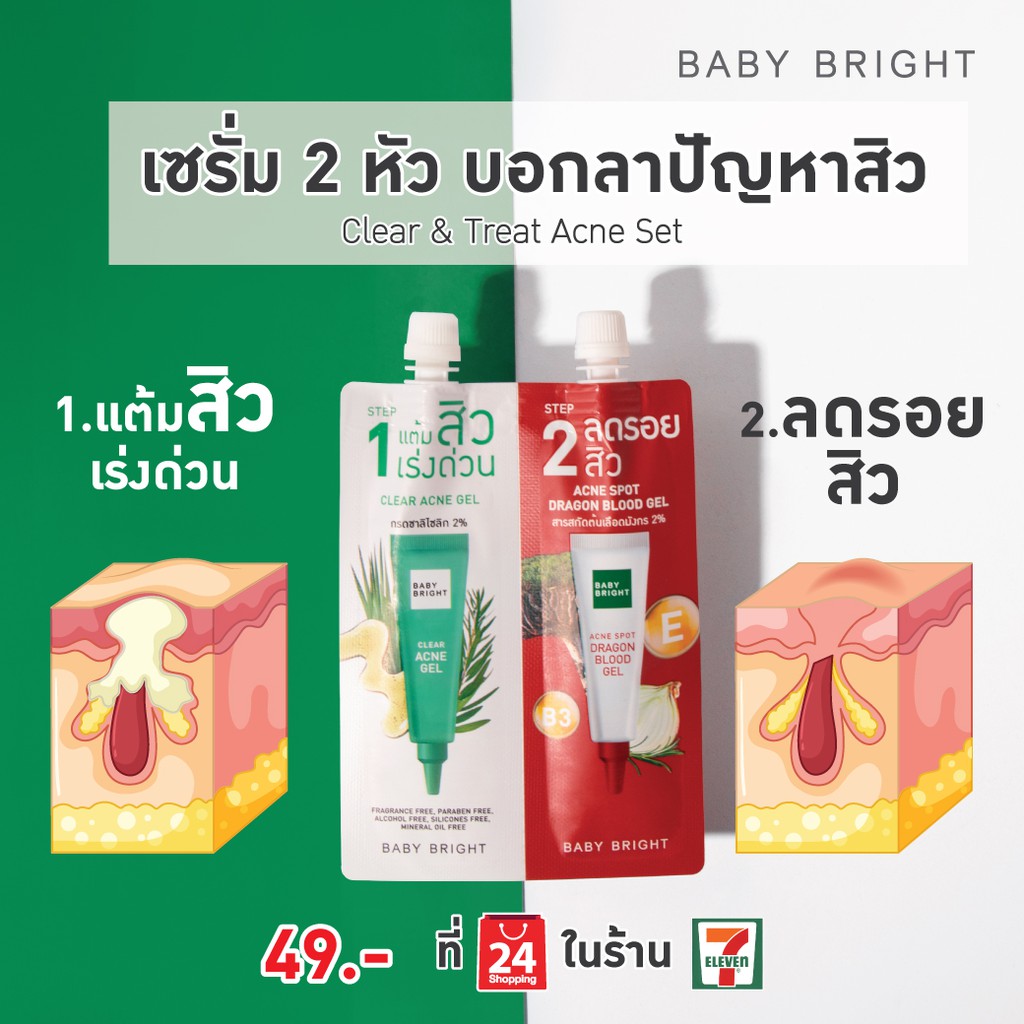 ถูกมาก-baby-bright-clear-amp-treat-acne-set-เบบี้-ไบร์ท-เคลียร์แอนด์ทรีทแอคเน่เซ็ท