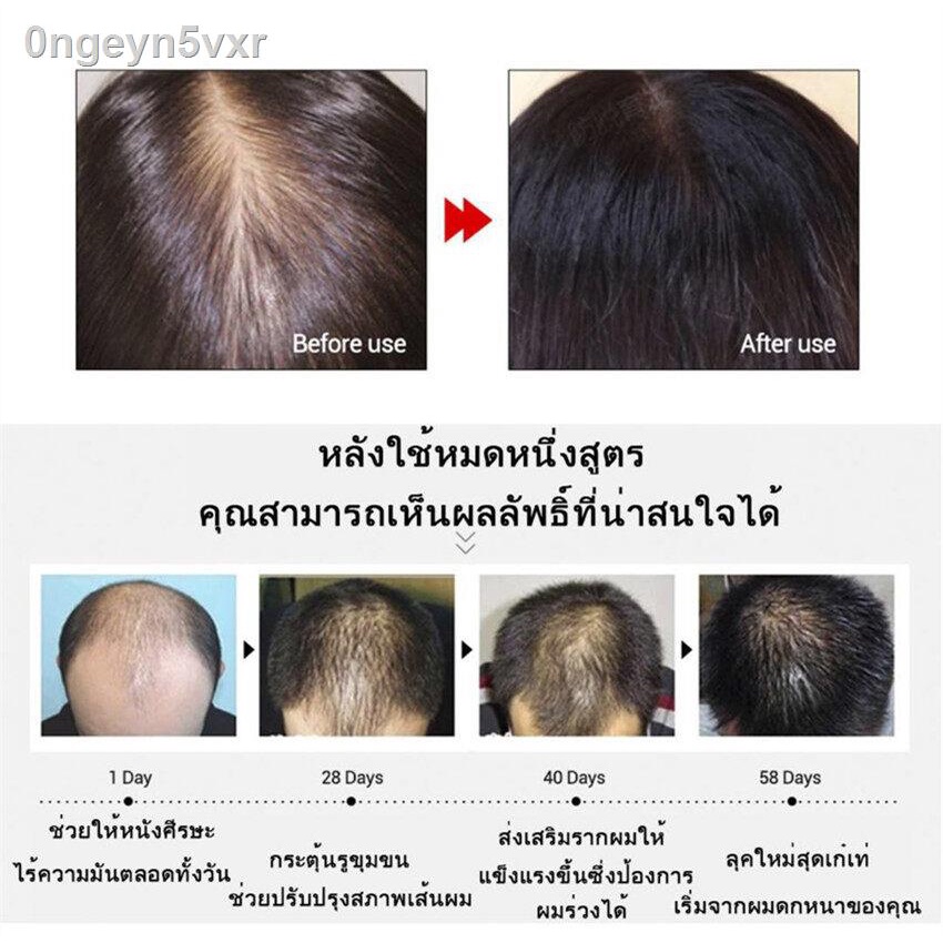 เห็นผลภายใน3วัน-vibrant-glamour-สเปรย์ปลูกผม-30g-ปรับปรุงคุณภาพของเส้นผม-ป้องกันผมร่วง-เร่งผมขึ้นใหม่-แก้ปัญหาหัวล้าน-เร