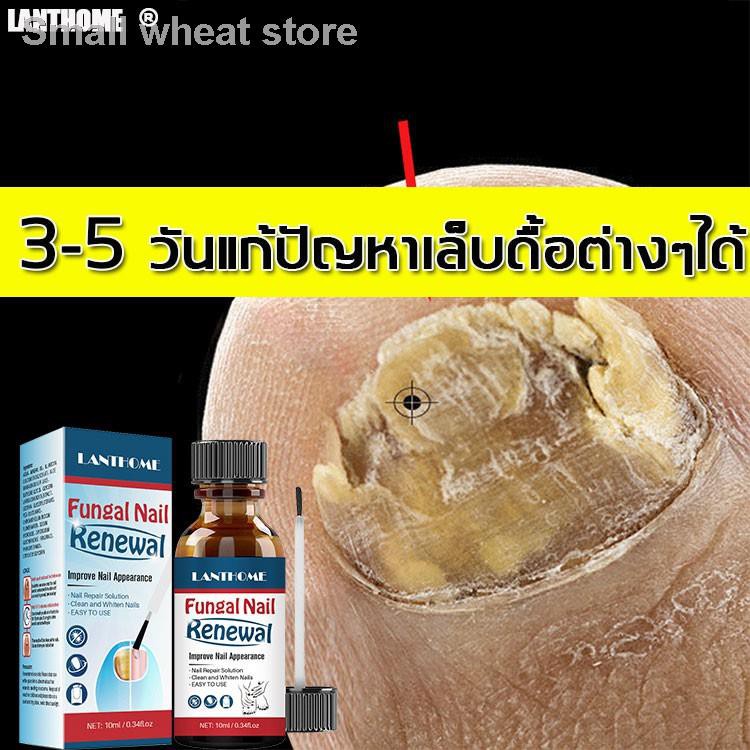 ภาพสินค้า*ส่งจากไทย* Lanthome ยาเชื้อราเล็บ ซ่อมแซมเล็บเสีย รหัส 85052 กำจัดเล็บเสีย ส่งเสริมการเจริญเติบโตของเล็บดีเยี่ยม จากร้าน fairy_mall บน Shopee ภาพที่ 1