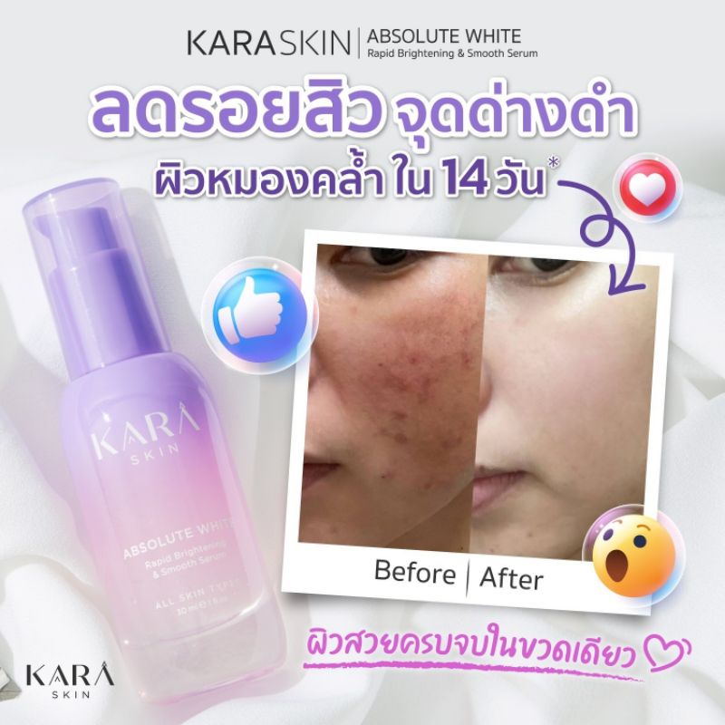 ถูกกว่านี้ไม่มีอีกแล้ว-ซื้อ-1-แถม-1-kara-skin-เซรั่มหน้าใส-14-วัน