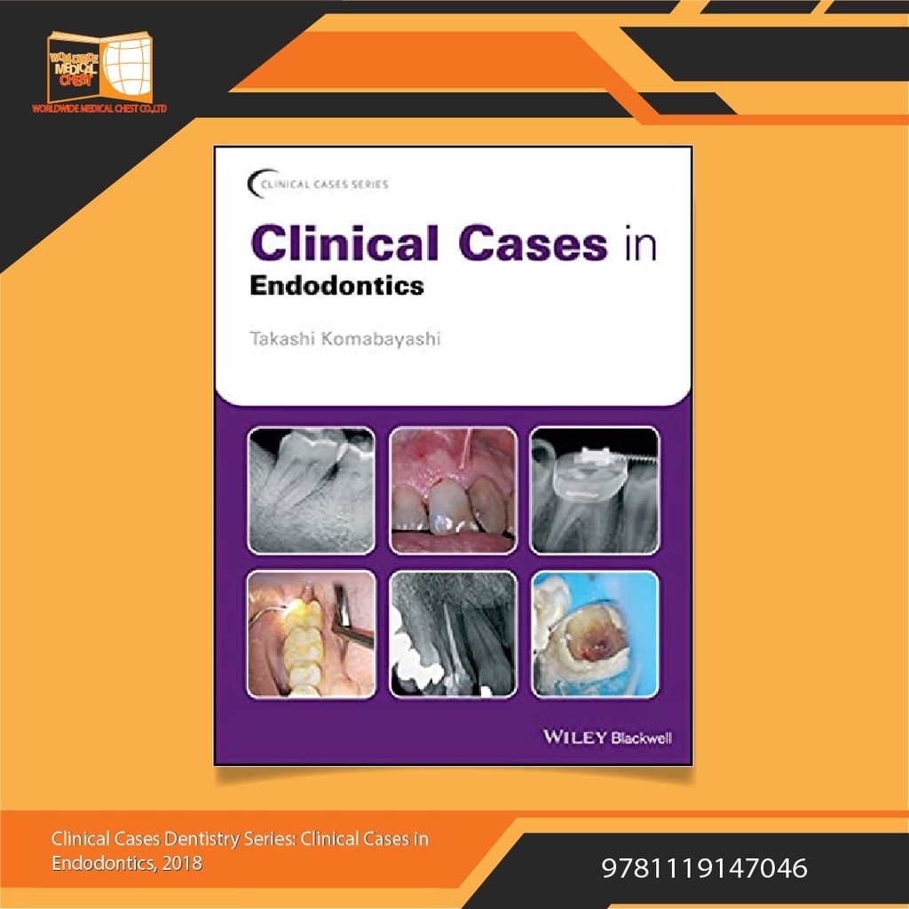 Clinical Cases in Endodontics | Shopee Thailand